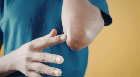 Treadmills and joints: is running bad for your knees?