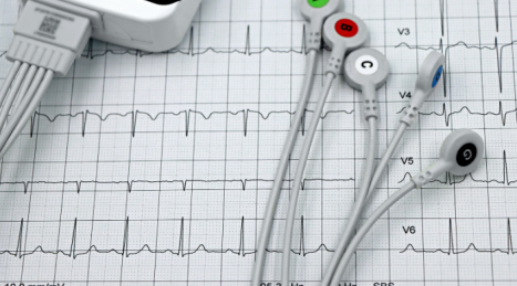 Riabilitazione Cardiologica: Protocolli di Carico in Palestra