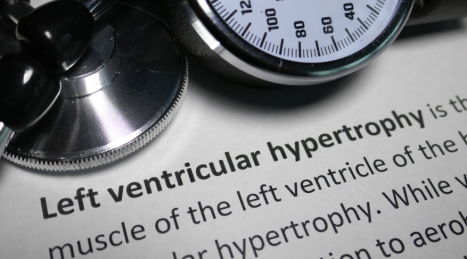 What is muscle hypertrophy and how does it work?