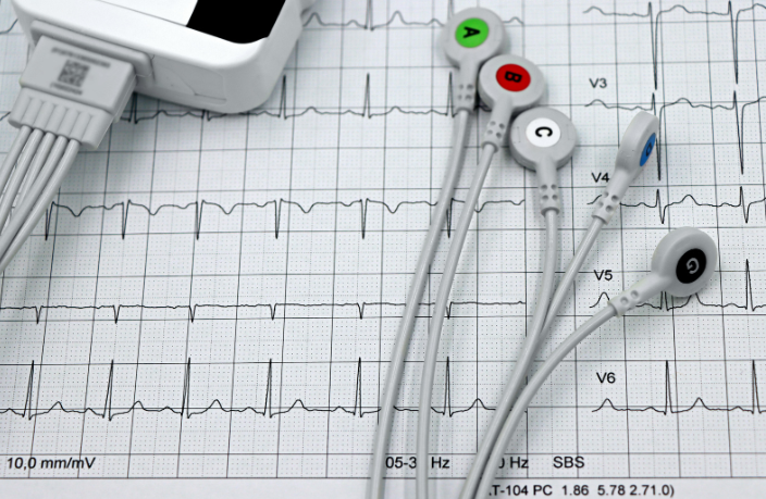 Riabilitazione Cardiologica: Protocolli di Carico in Palestra