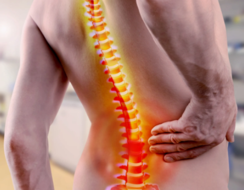 Iperlordosi lombare: come riconoscerla e quali esercizi fare (senza estremismi)